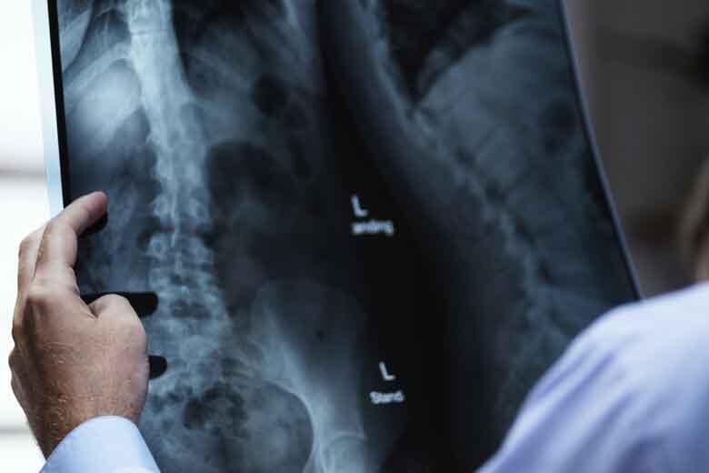 campanha radiografia